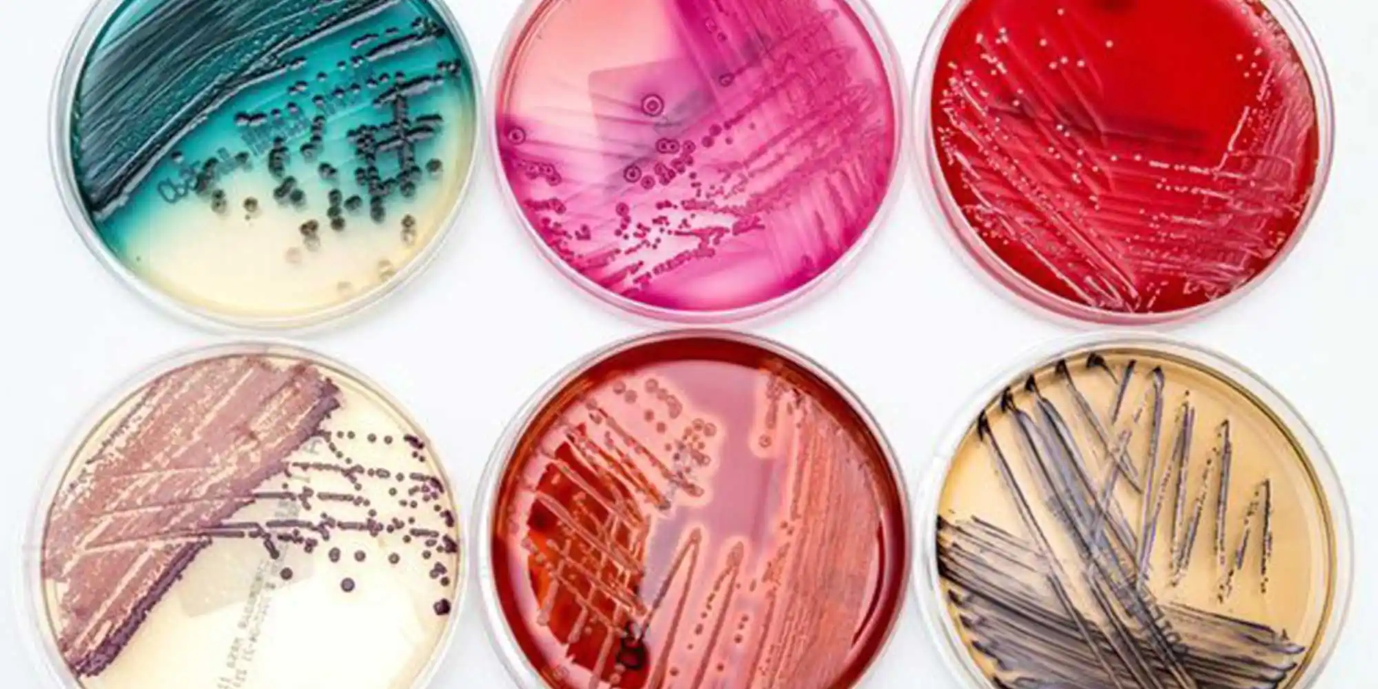 کشت میکروبی