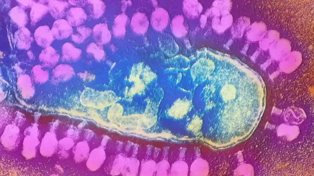 اکسی تتراسایکلین